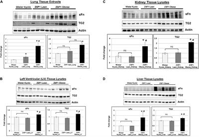 Increased Transglutaminase 2 Expression and Activity in Rodent Models of Obesity/Metabolic Syndrome and Aging